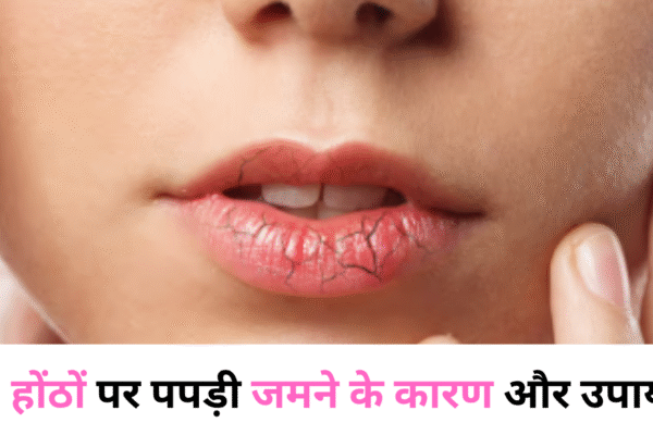 होंठों पर पपड़ी जमने के कारण और उपाय