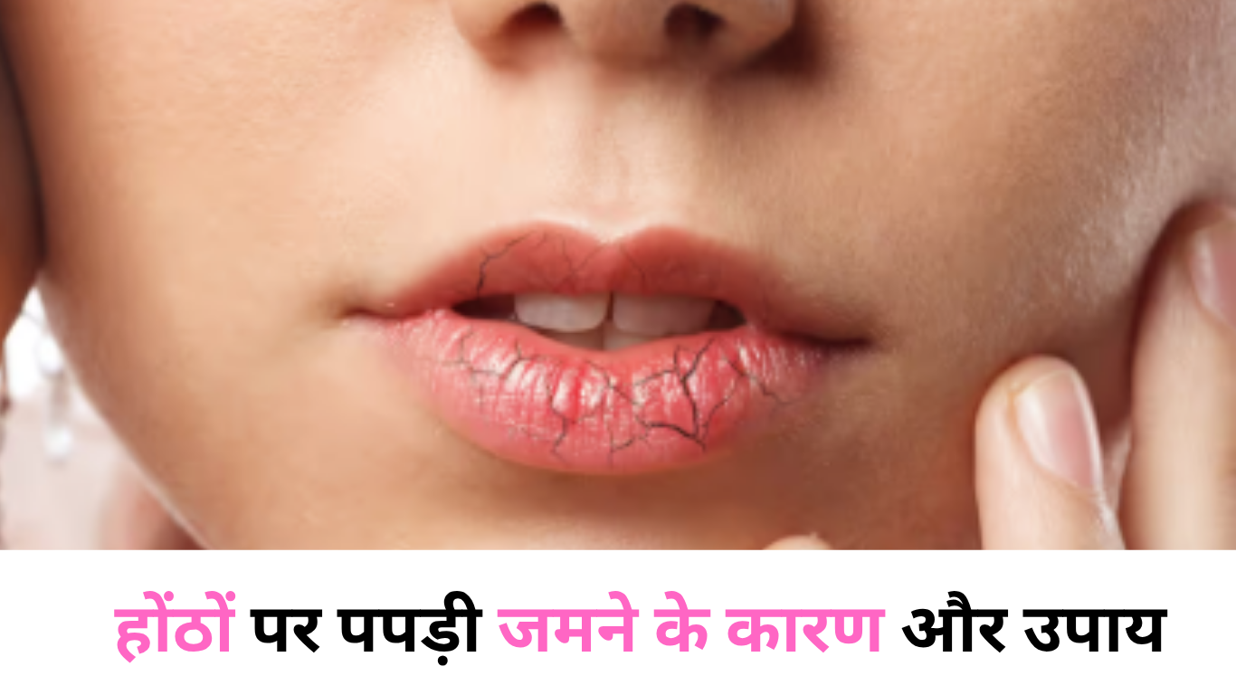 होंठों पर पपड़ी जमने के कारण और उपाय